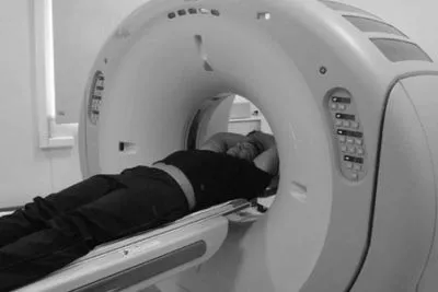 Деформуючий спондильоз шийного відділу хребта: симптоми і лікування, що це таке? хребта