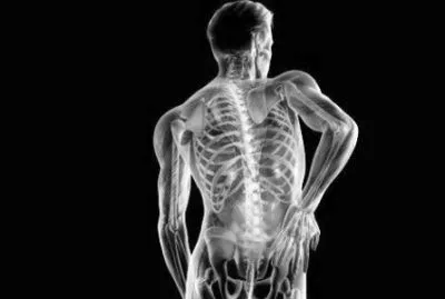 Деформуючий спондильоз шийного відділу хребта: симптоми і лікування, що це таке? деформуючий