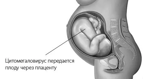вагітності