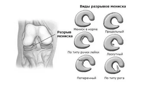 його