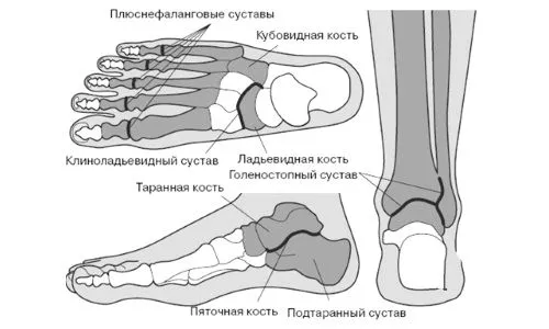 як лікувати розтягнення стопи