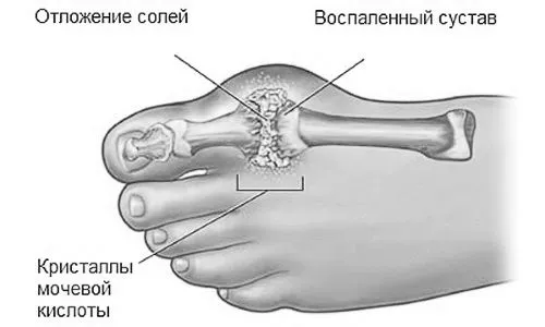меніск