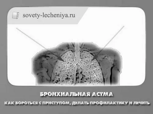 профілактику