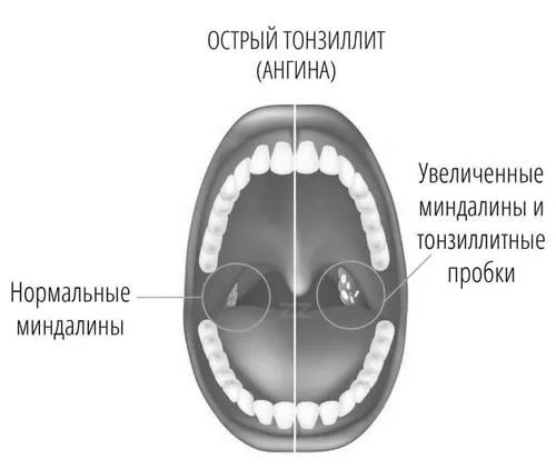 вагітності
