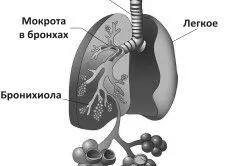 Двостороння пневмонія: причини, симптоми і лікування як лікувати двосторонню пневмонію