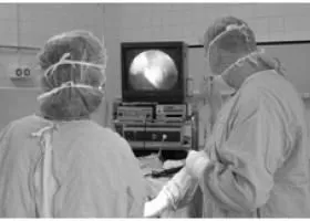Ендометріоїдна кіста яєчника: що це таке ендометріоїдна