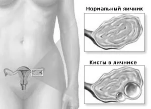 двокамерна