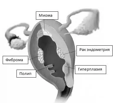 симптоми