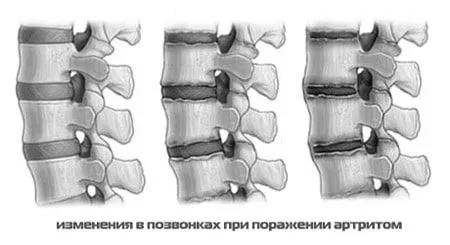 дієта