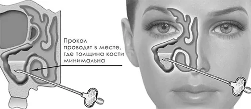 лікувати