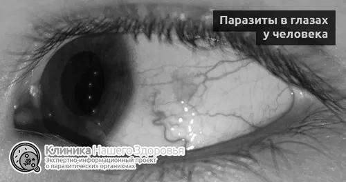 очах