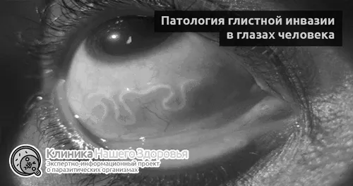 симптоми