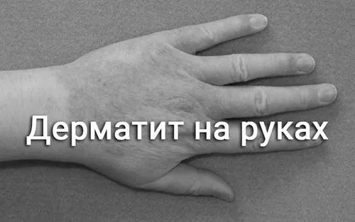 проблеми
