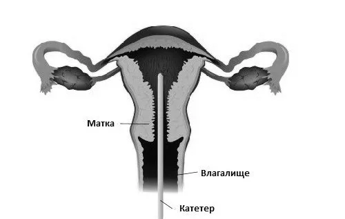 клімаксі