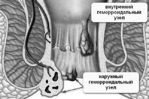 виліз