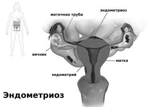 лікування