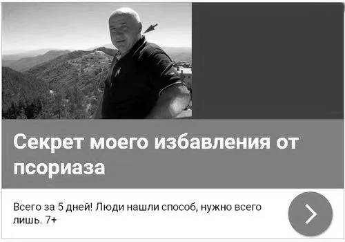 псоріаз