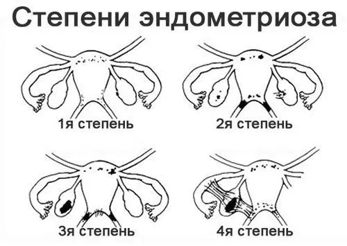 ступеня