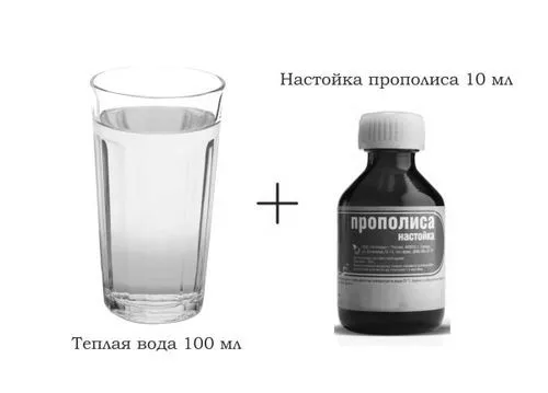 як лікувати флюс настоянкою прополісу