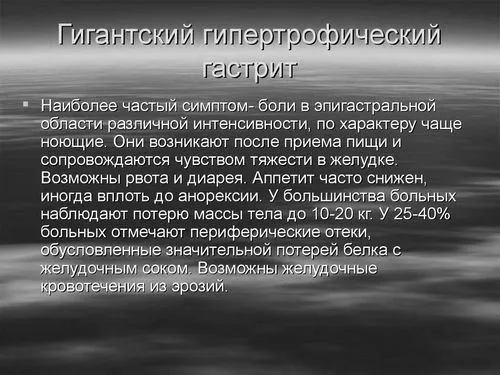 шлунка