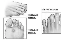 здорові стопи