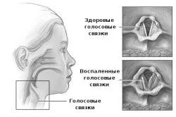 умовах