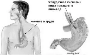 симптоми