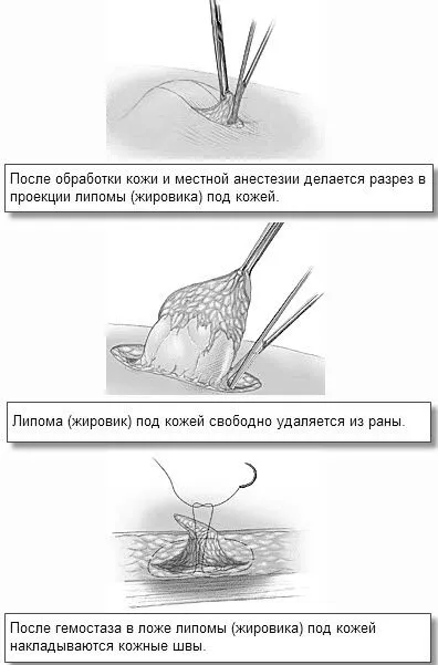голові
