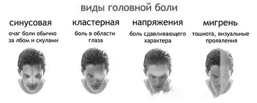 як лікувати головний біль мігрень
