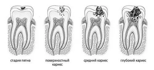 види