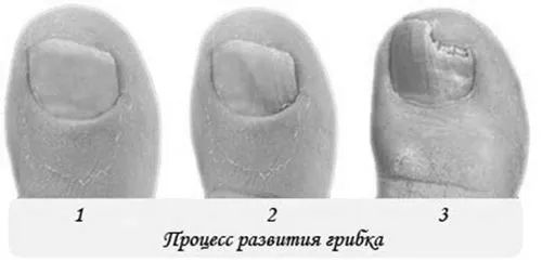 нігті