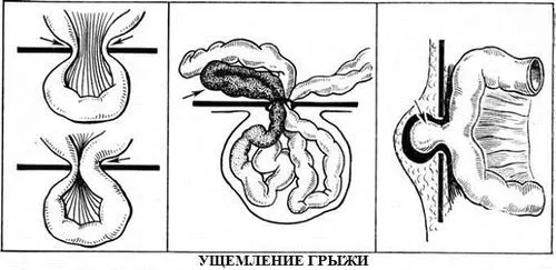 симптоми