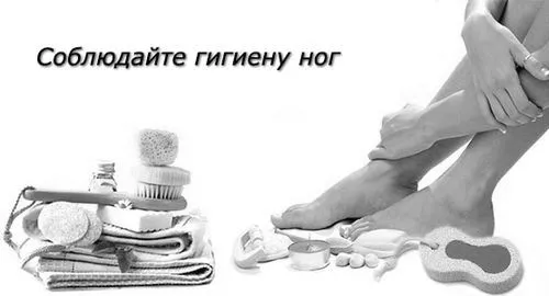 Грибок народне лікування як вилікувати мікоз нігтів народними засобами