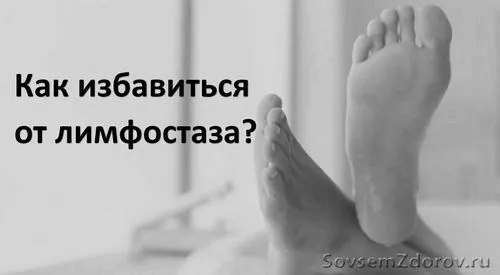 лимфостаза