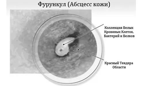 лікувати