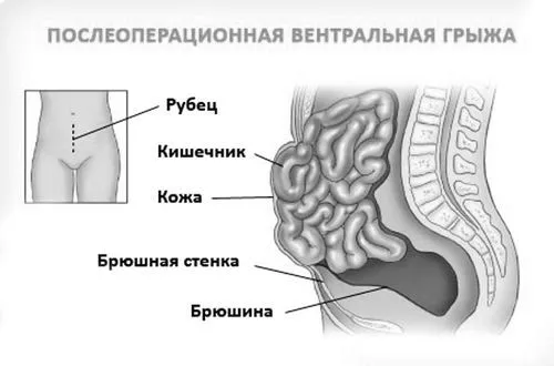 причини