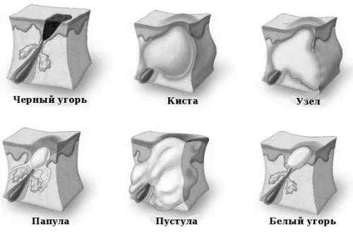 позбутися