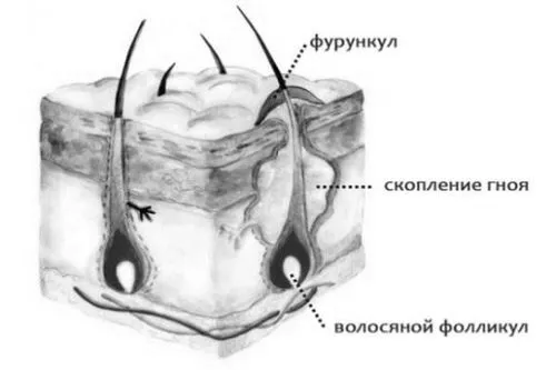 лікувати