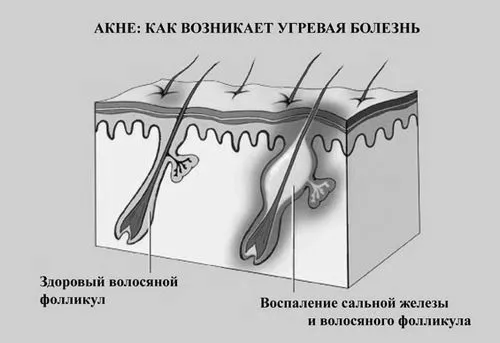 позбутися