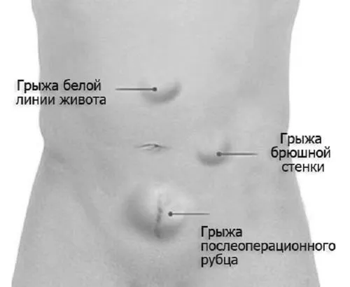 живота