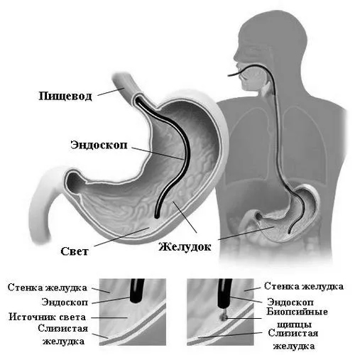 шлунка