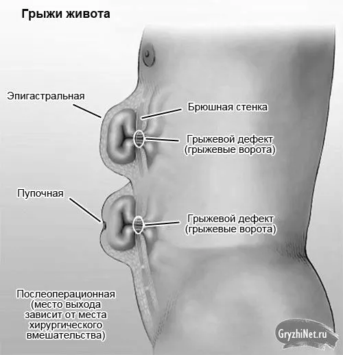 симптоми