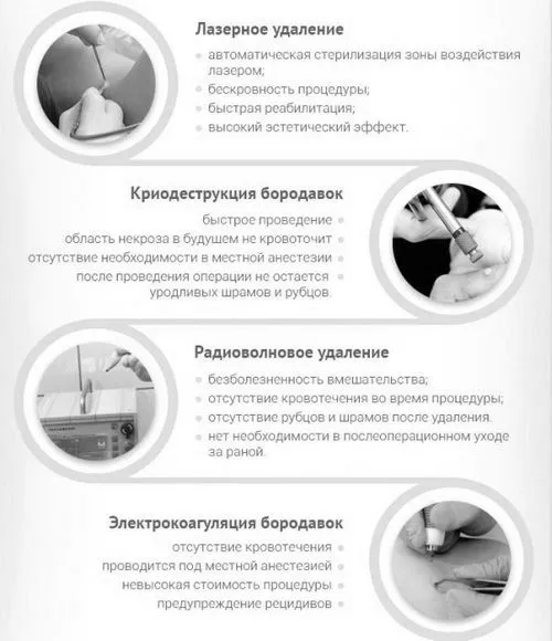 як позбутися від бородавки на пальці на руці