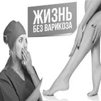 як лікувати варикоз у чоловіків