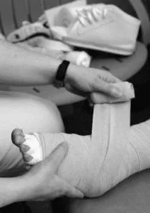 як лікувати лімфостаз після операції