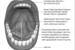 Як зміцнити ясна як лікувати пухкі ясна