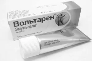 як лікувати радикуліт банками