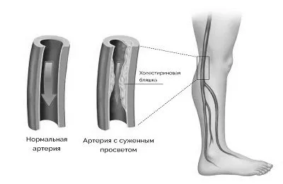 мозку