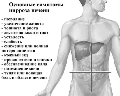 Як розвивається цироз печінки як лікувати цироз печінки