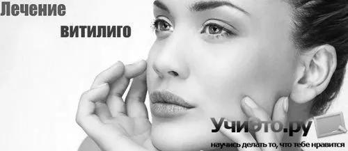 умовах
